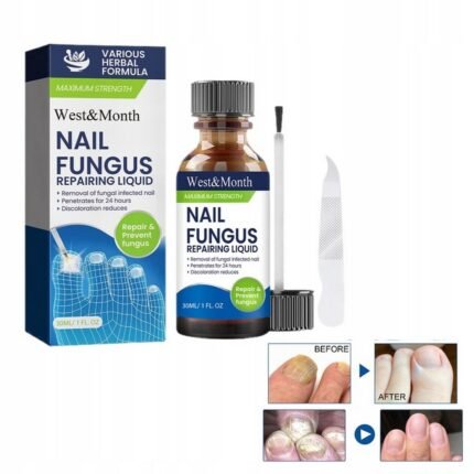 Nails affected by fungus,-2szt Intensity Leczenie Grzybicy Paznokci - Naprawa i Zagęszczanie Paznokci, 30 ml, Weak and brittle nails,-2szt Intensity Leczenie Grzybicy Paznokci - Naprawa i Zagęszczanie Paznokci, 30 ml, Nail splitting and peeling,-2szt Intensity Leczenie Grzybicy Paznokci - Naprawa i Zagęszczanie Paznokci, 30 ml, Slow nail growth,-2szt Intensity Leczenie Grzybicy Paznokci - Naprawa i Zagęszczanie Paznokci, 30 ml.